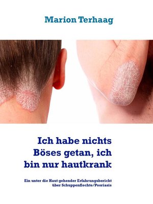 cover image of Ich habe nichts Böses getan, ich bin nur hautkrank
